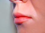 Lip enhancement plastic surgery
